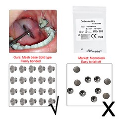 27 Options Dental Orthodontic Bondable Lingual Buttons Round/Rectangular Base