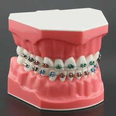 Dental High Quality Orthodontic Demonstration Model With Brackets Buccal Tubes