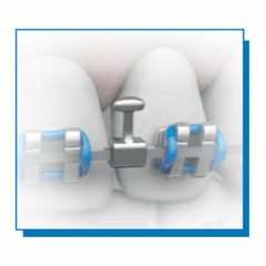 Orthodontic Straight Universal Ball Tip Bi-Directional Crimpable split Hooks