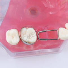 10-Size Dental Teeth Missing Maintainer Bands Space Retainer Band Molar Adjacent