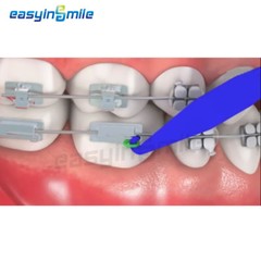 Dental Disposable Ortho Elastic Rubber Placer For Brace Band Mixed Color 100Pcs